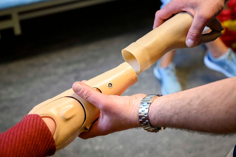 Trøndelag Ortopediske Verksted pasient